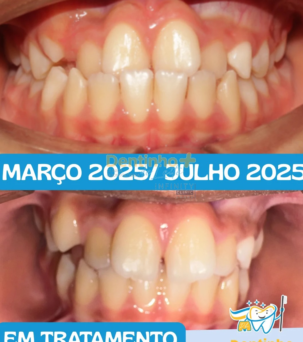 Resultado - Caso 08