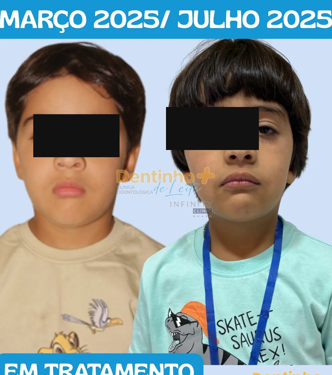 Resultado - Caso 09